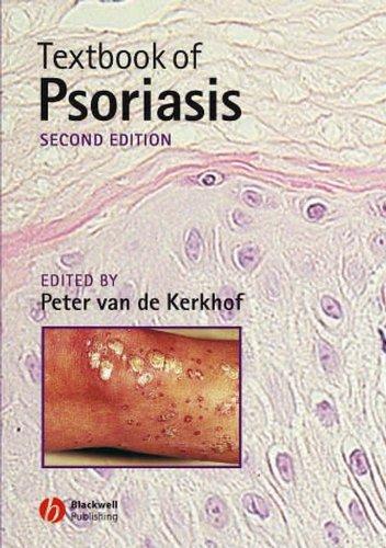 POP UP-TEXTBK OF PSORIASIS REV