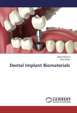 Dental Implant Biomaterials