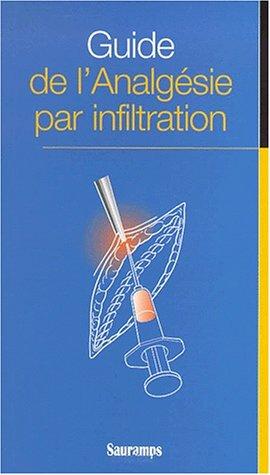 Guide de l'analgésie par infiltration