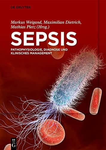 Sepsis: Pathophysiologie, Diagnose und klinisches Management