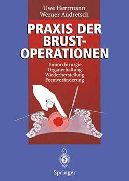 Praxis der Brustoperationen: Tumorchirurgie - Organerhaltung - Wiederherstellung - Formveränderung (German Edition)