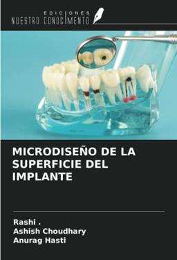 MICRODISEÑO DE LA SUPERFICIE DEL IMPLANTE