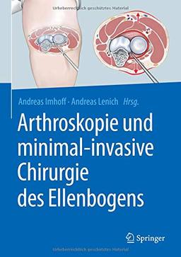 Arthroskopie und minimal-invasive Chirurgie des Ellenbogens