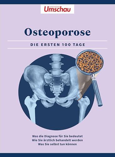 Apotheken Umschau: Osteoporose: Die ersten 100 Tage. Was die Diagnose bedeutet - Wie Sie ärztlich behandelt werden - Was Sie selbst tun können (Die Buchreihe der Apotheken Umschau)