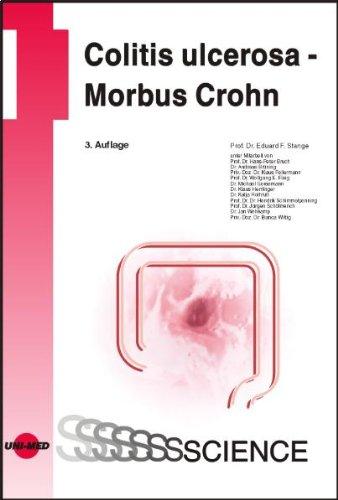 Colitis ulcerosa - Morbus Crohn