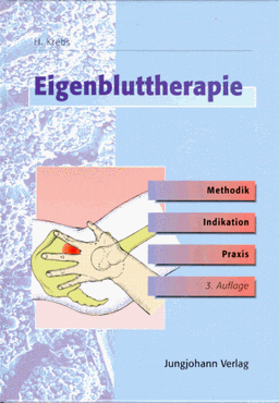 Eigenbluttherapie