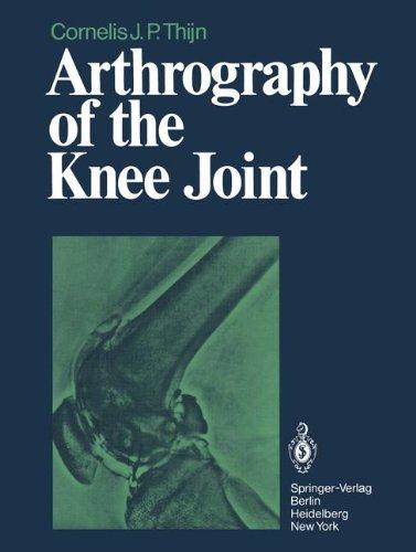 Arthrography of the Knee Joint