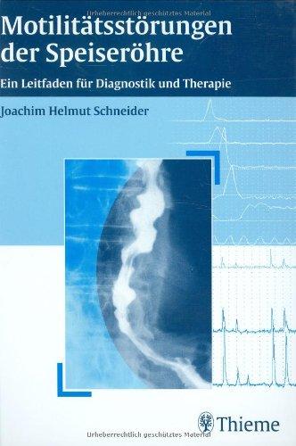 Motilitätsstörungen der Speiseröhre: Ein Leitfaden für Diagnostik und Therapie