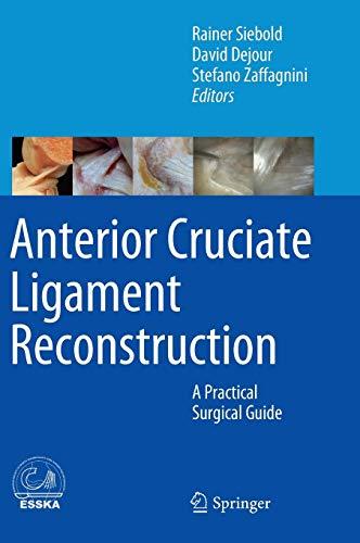 Anterior Cruciate Ligament Reconstruction: A Practical Surgical Guide