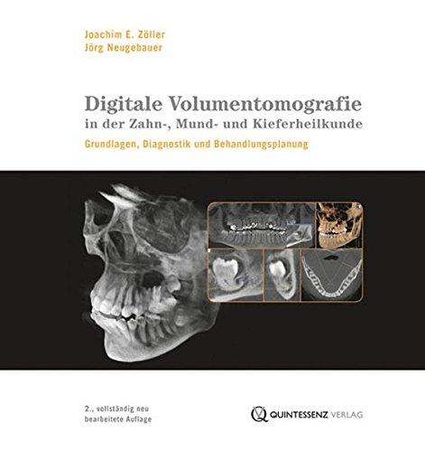 Digitale Volumentomografie in der Zahn-, Mund- und Kieferheilkunde: Grundlagen, Diagnostik und Therapieplanung (mit DVD-ROM)