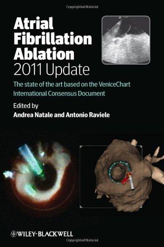 Atrial Fibrillation Ablation, 2011 Update: The State of the Art Based on the Venicechart International Consensus Document