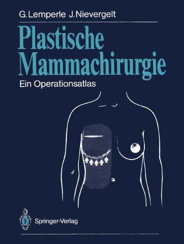 Plastische Mammachirurgie: Ein Operationsatlas