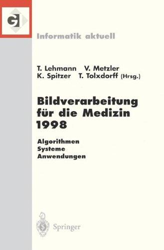 Bildverarbeitung für die Medizin 1998 (Informatik aktuell)