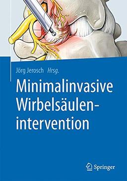 Minimalinvasive Wirbelsäulenintervention