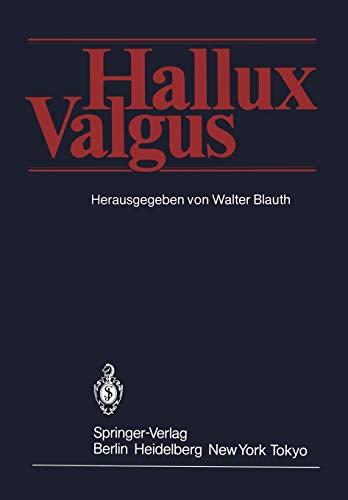 Hallux Valgus