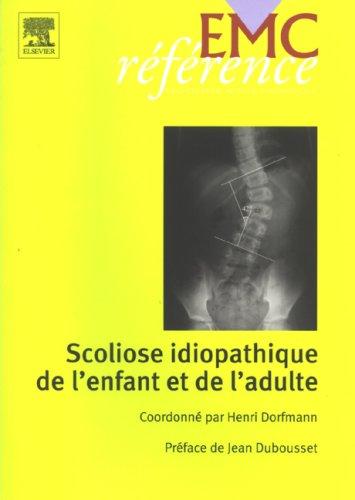 Scoliose idiopathique de l'enfant et de l'adulte