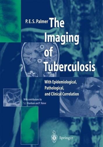 The Imaging of Tuberculosis: With Epidemiological, Pathological, and Clinical Correlation