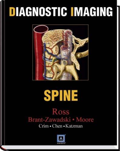 Diagnostic Imaging - Spine (Saunders W.B.)