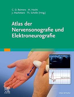 Atlas der Nervensonografie und Elektroneurografie