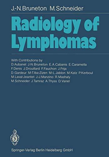 Radiology of Lymphomas