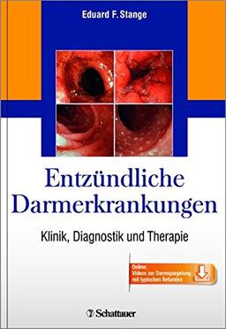 Entzündliche Darmerkrankungen: Klinik, Diagnostik und Therapie - Online: Videos zur Darmspiegelung mit typischen Befunden