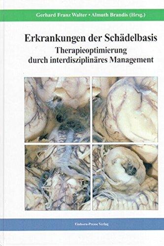 Erkrankungen der Schädelbasis - Therapieoptimierung durch interdisziplinares Management