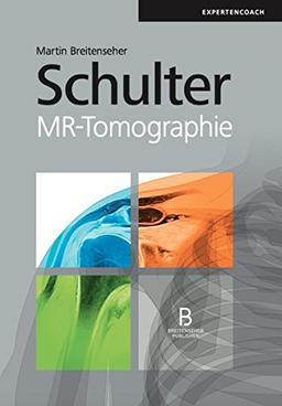 Schulter: MR-Tomographie