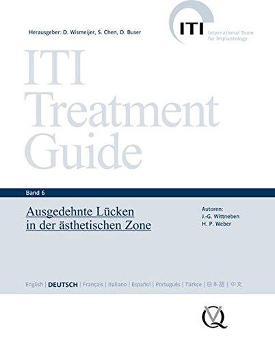 ITI Treatment Guide Band 6: Ausgedehnte Lücken in der ästhetischen Zone