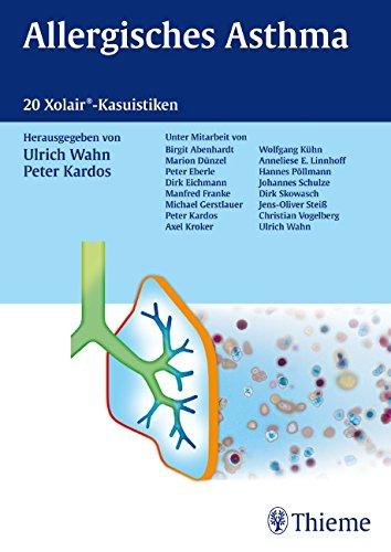 Allergisches Asthma: 20 Xolair-Kasuistiken