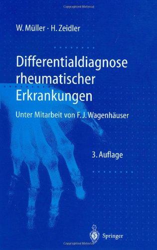 Differentialdiagnose rheumatischer Erkrankungen