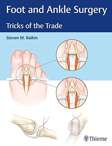 Foot and Ankle Surgery: Tricks of the Trade