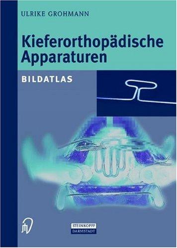 Kieferorthopädische Apparaturen. Bildatlas