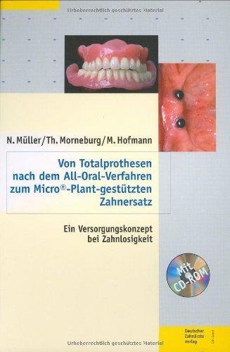 Von Totalprothesen nach dem All-Oral-Verfahren zum Micro-Plant-gestützten Zahnersatz. Ein Versorgungskonzept bei Zahnlosigkeit