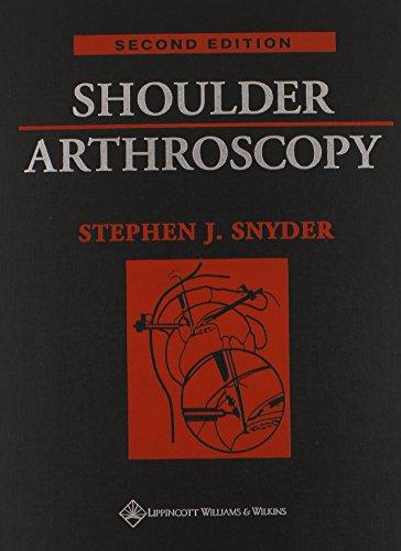 Shoulder Arthroscopy