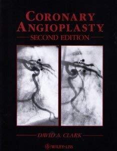 Coronary Angioplasty