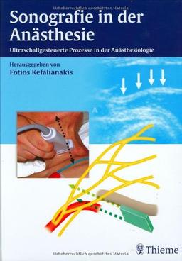 Sonographie in der Anästhesie. Ultraschallgesteuerte Prozesse in der Anästhesiologie