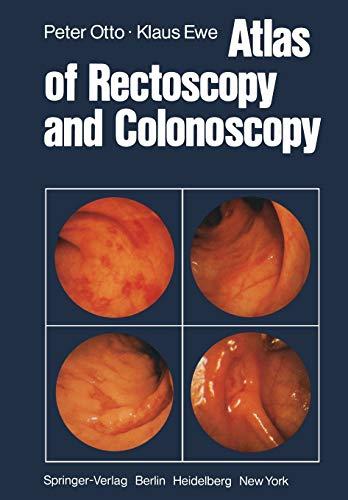 Atlas of Rectoscopy and Colonoscopy