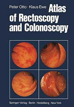 Atlas of Rectoscopy and Colonoscopy