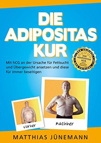 Die Adipositas-Kur: Mit hCG an der Ursache für Fettsucht und Übergewicht ansetzen und diese für immer beseitigen