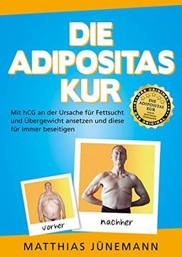 Die Adipositas-Kur: Mit hCG an der Ursache für Fettsucht und Übergewicht ansetzen und diese für immer beseitigen