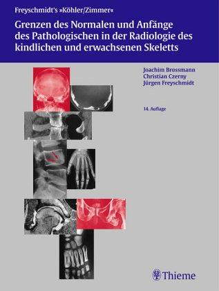 Grenzen des Normalen und Anfänge des Pathologischen im Röntgenbild des Skeletts