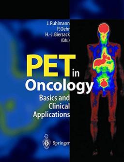 PET in Oncology: Basics and Clinical Application