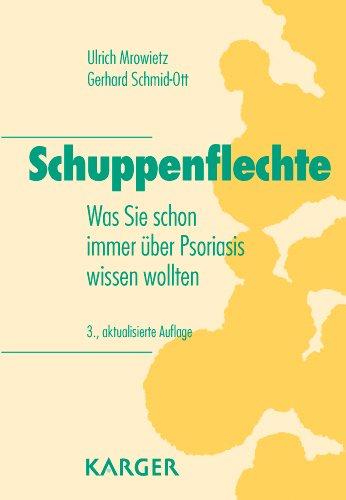 Schuppenflechte: Was Sie schon immer ueber Psoriasis wissen wollten