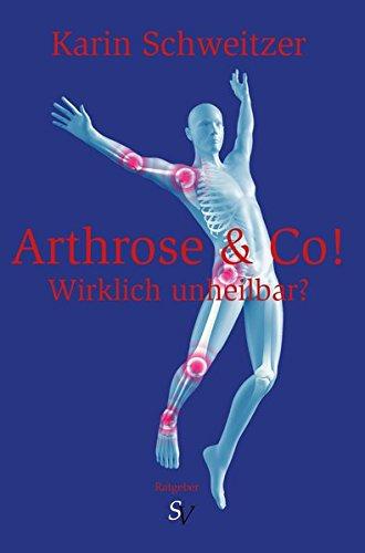 Arthrose & Co - Wirklich unheilbar?: Ratgeber