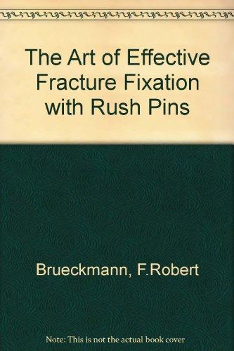 The Art of Effective Fracture Fixation with Rush Pins