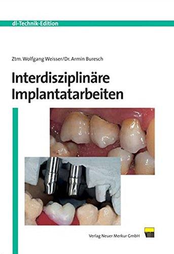 Interdisziplinäre Implantatarbeiten (DL Technik)