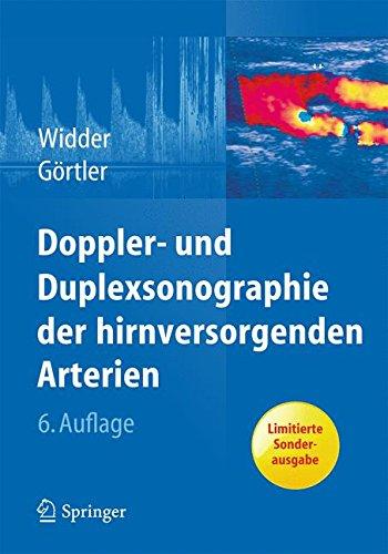 Doppler- und Duplexsonographie der hirnversorgenden Arterien