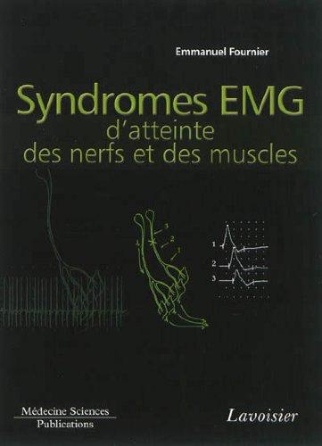 Electromyographie. Vol. 4. Syndromes EMG d'atteinte des nerfs et des muscles