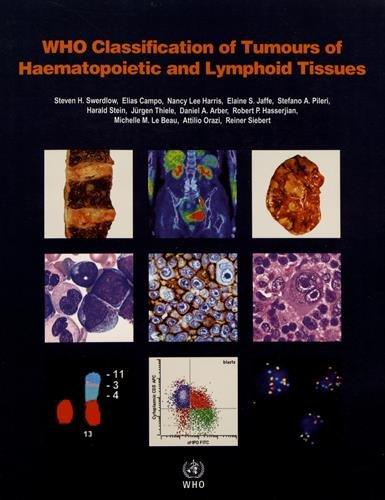 WHO Classification of Tumours of Haematopoietic and Lymphoid Tissues (World Health Organization Classification of Tumours, Band 2)