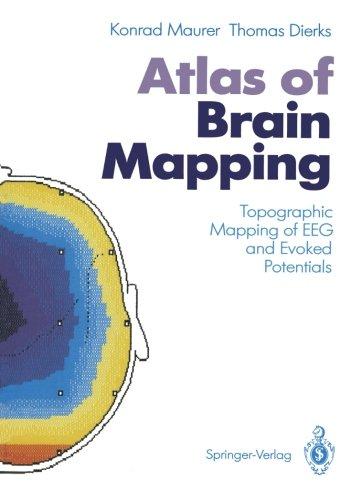 Atlas of Brain Mapping: Topographic Mapping of Eeg and Evoked Potentials